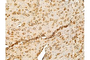 ABIN7094672 and ABIN7098723 at 1/100 staining Rat brain tissue by IHC-P.