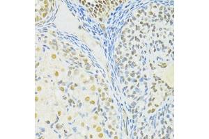 Immunohistochemistry of paraffin-embedded rat ovary using BRCA1 antibody (ABIN6291827) at dilution of 1:100 (40x lens). (BRCA1 antibody)
