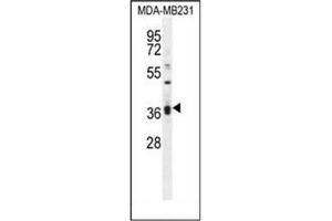 Western blot analysis of KLHL35 Antibody (C-term) in MDA-MB231 cell line lysates (35ug/lane). (KLHL35 antibody  (C-Term))
