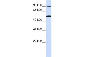 WB Suggested Anti-RHBDF1 Antibody Titration:  0. (RHBDF1 antibody  (N-Term))