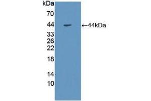Western blot analysis of recombinant Human GHR. (Growth Hormone Receptor antibody  (AA 315-574))