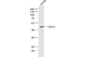 SW480 lysates probed with ERO1L Polyclonal Antibody, Unconjugated  at 1:300 dilution and 4˚C overnight incubation. (ERO1L antibody  (AA 321-420))