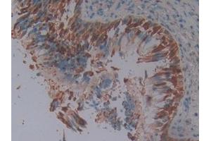 #VALUE! (SERPINB3 antibody  (AA 1-210))