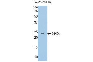 Western Blotting (WB) image for anti-Homogentisate 1,2-Dioxygenase (HGD) (AA 8-205) antibody (ABIN1176266) (HGD antibody  (AA 8-205))