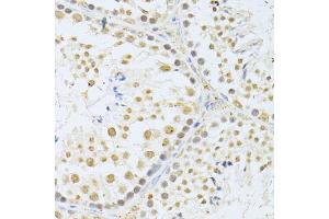 Immunohistochemistry of paraffin-embedded mouse testis using AKT1 antibody (ABIN5997218) at dilution of 1/100 (40x lens). (AKT1 antibody)