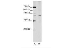 Image no. 3 for anti-Surfeit 6 (SURF6) (AA 191-240) antibody (ABIN202343) (SURF6 antibody  (AA 191-240))