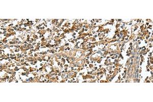 Immunohistochemistry of paraffin-embedded Human tonsil tissue using RAB23 Polyclonal Antibody at dilution of 1:50(x200) (RAB23 antibody)