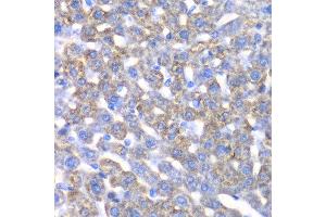 Immunohistochemistry of paraffin-embedded mouse liver using CCBL1 antibody at dilution of 1:100 (x40 lens). (CCBL1 antibody)