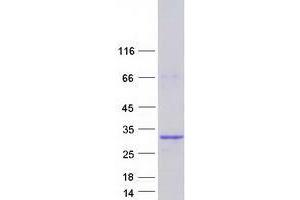Western Blotting (WB) image for Vestigial Like 4 (VGLL4) (Transcript Variant 4) protein (Myc-DYKDDDDK Tag) (ABIN2735253)