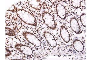 Image no. 1 for anti-Suppressor of Cytokine Signaling 3 (SOCS3) (AA 1-226) antibody (ABIN465973) (SOCS3 antibody  (AA 1-226))