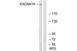 Western Blotting (WB) image for anti-Calcium Channel, Voltage-Dependent, T Type, alpha 1H Subunit (CACNA1H) (AA 462-511) antibody (ABIN2890690) (CACNA1H antibody  (AA 462-511))