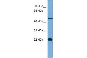 WB Suggested Anti-HEMGN Antibody Titration: 0. (HEMGN antibody  (N-Term))