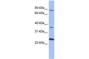 Image no. 1 for anti-Membrane Protein, Palmitoylated 3 (MAGUK P55 Subfamily Member 3) (MPP3) (AA 35-84) antibody (ABIN6744048)
