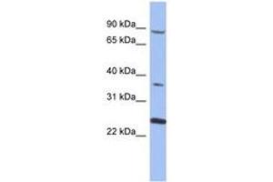 Image no. 1 for anti-Membrane Protein, Palmitoylated 3 (MAGUK P55 Subfamily Member 3) (MPP3) (AA 35-84) antibody (ABIN6744048) (MPP3 antibody  (AA 35-84))