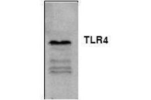 Image no. 1 for anti-Toll-Like Receptor 4 (TLR4) antibody (ABIN127057) (TLR4 antibody)