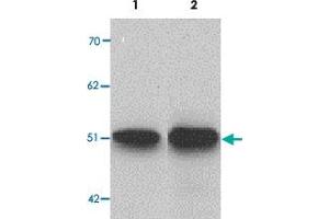 Western blot analysis of ZIP9 in HepG2 cell lysate with SLC39A9 polyclonal antibody  at 1 ug/mL (lane 1) and 2 ug/mL (lane 2). (SLC39A9 antibody  (N-Term))