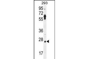 LRRC57 Antibody (C-term) (ABIN654494 and ABIN2844226) western blot analysis in 293 cell line lysates (35 μg/lane). (LRRC57 antibody  (C-Term))