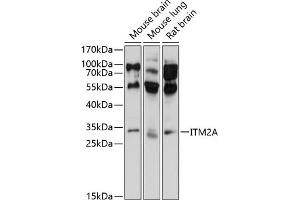 Western blot analysis of extracts of various cell lines, using ITM2A antibody (ABIN6128106, ABIN6142603, ABIN6142604 and ABIN6214624) at 1:1000 dilution. (ITM2A antibody  (AA 1-263))