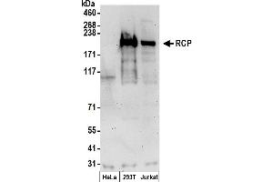 anti-Rab11 Family-Interacting Protein 1 (RAB11FIP1) (AA 675-725) antibody
