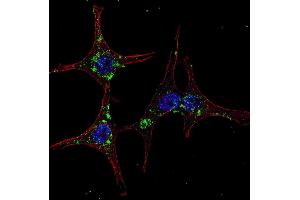 Fluorescent confocal image of HeLa cells stained with SYVN1 (HRD1) antibody.