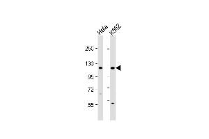 Western Blot at 1:1000 dilution Lane 1: Hela whole cell lysate Lane 2: K562 whole cell lysate Lysates/proteins at 20 ug per lane. (DDX11 antibody  (C-Term))