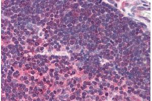 Human Thymus (formalin-fixed, paraffin-embedded) stained with UNC13D antibody ABIN290189 at 2. (UNC13D antibody  (AA 967-980))