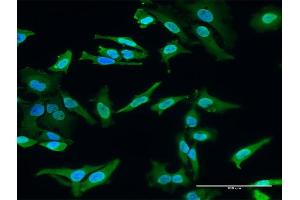 Immunofluorescence of monoclonal antibody to HECTD2 on HeLa cell. (HECTD2 antibody  (AA 331-440))