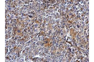 IHC-P Image BTK antibody [C1C3] detects BTK protein at cytosol on mouse spleen by immunohistochemical analysis. (BTK antibody  (C-Term))