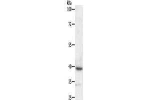 Deltex Homolog 3 antibody