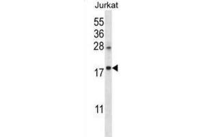 Western Blotting (WB) image for anti-Keratin Associated Protein 25-1 (KRTAP25-1) antibody (ABIN2996683)