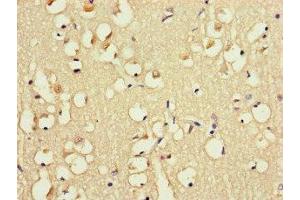 Immunohistochemistry of paraffin-embedded human brain tissue using ABIN7152623 at dilution of 1:100 (FABP7 antibody  (AA 2-132))