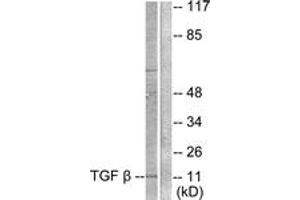 Western blot analysis of extracts from COS7 cells, using TGF beta3 Antibody. (TGFB3 antibody  (AA 261-310))