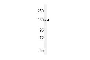 BUB1A Antibody  (ABIN392626 and ABIN2842136) western blot analysis in T47D cell line lysates (35 μg/lane). (BUB1 antibody  (C-Term))