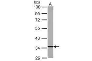 Image no. 2 for anti-2,4-Dienoyl CoA Reductase 1, Mitochondrial (DECR1) (AA 20-276) antibody (ABIN1497807) (DECR1 antibody  (AA 20-276))