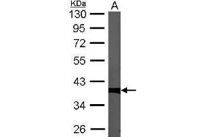 PPP1CC antibody  (Center)