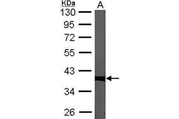 PPP1CC antibody  (Center)