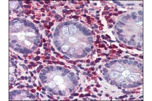 AP22453PU-N TRIM21 antibody staining of Formalin-Fixed, Paraffin-Embedded Human Colon at 5 µg/ml using Biotin conjugated anti-Goat IgG secondary antibody, Alkaline Phosphatase-Streptavidin and Chromogen. (TRIM21 antibody  (C-Term))