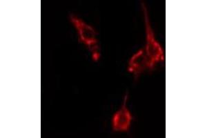 ABIN6274885 staining HepG2 cells by IF/ICC. (ABCD4 antibody  (Internal Region))