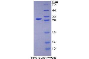 SDS-PAGE (SDS) image for Glutathione Reductase (GSR) (AA 7-246) protein (His tag) (ABIN2124998)