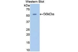 Detection of Recombinant AGT, Mouse using Polyclonal Antibody to Angiotensinogen (AGT) (AGT antibody  (AA 23-477))