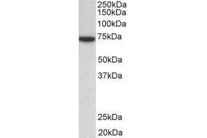 Western Blotting (WB) image for anti-zeta-Chain (TCR) Associated Protein Kinase 70kDa (ZAP70) (Internal Region) antibody (ABIN2465058) (ZAP70 antibody  (Internal Region))