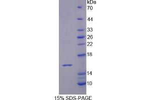 Image no. 1 for Interleukin 16 (IL16) (AA 508-627) protein (His tag) (ABIN6236560) (IL16 Protein (AA 508-627) (His tag))