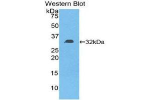 Western Blotting (WB) image for anti-Diacylglycerol Kinase, epsilon 64kDa (DGKE) (AA 243-502) antibody (ABIN1858630) (DGKE antibody  (AA 243-502))