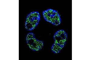Immunofluorescence (IF) image for anti-Frequently Rearranged in Advanced T-Cell Lymphomas 2 (FRAT2) (AA 203-230), (C-Term) antibody (ABIN655793)