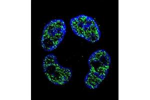 Confocal immunofluorescent analysis of FRAT2 Antibody (C-term) (ABIN655793 and ABIN2845223) with ZR-75-1 cell followed by Alexa Fluor 488-conjugated goat anti-rabbit lgG (green). (FRAT2 antibody  (C-Term))