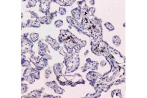 IHC testing of FFPE human placental tissue with DC-SIGN antibody at 1ug/ml. (DC-SIGN/CD209 antibody)