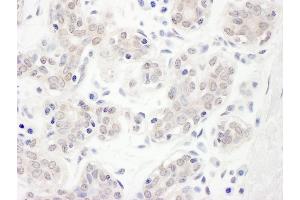 anti-Cas-Br-M (Murine) Ecotropic Retroviral Transforming Sequence-Like 1 (CBLL1) (AA 1-50) antibody