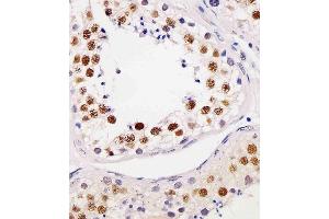 (ABIN6244015 and ABIN6577179) staining TE2IP in human testis tissue sections by Immunohistochemistry (IHC-P - paraformaldehyde-fixed, paraffin-embedded sections). (RAP1 antibody  (AA 1-399))