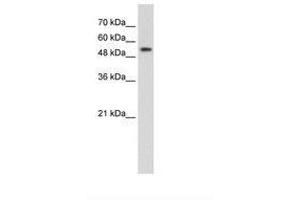 Image no. 2 for anti-Pre-mRNA Processing Factor 19 (PRPF19) (AA 151-200) antibody (ABIN203527) (PRP19 antibody  (AA 151-200))