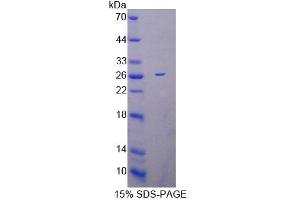 SDS-PAGE analysis of Mouse MRPL1 Protein.